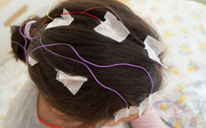A young girl is sitting while having an EEG test to check her brain activity